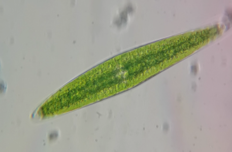 一种新月藻 [2] 疑似项圈新月藻